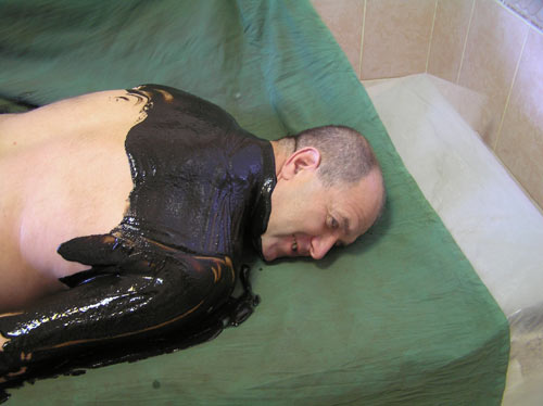 Грязелечение